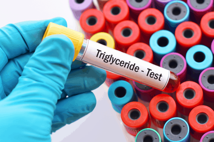chi-so-triglyceride