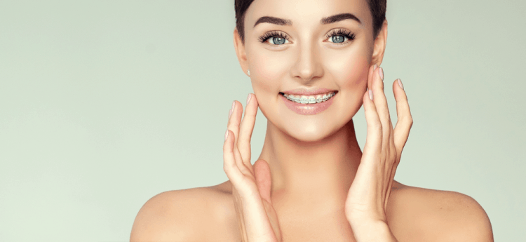 Giải đáp thắc mắc trước khi niềng răng