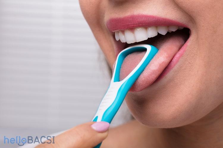 Vàng lưỡi: Triệu chứng, nguyên nhân và giải pháp điều trị