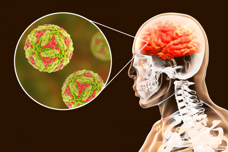 virus-herpes-simplex