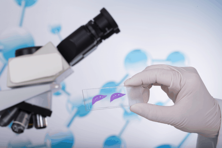 Sinh thiết gan và những điều bệnh nhân ung thư gan nên biết