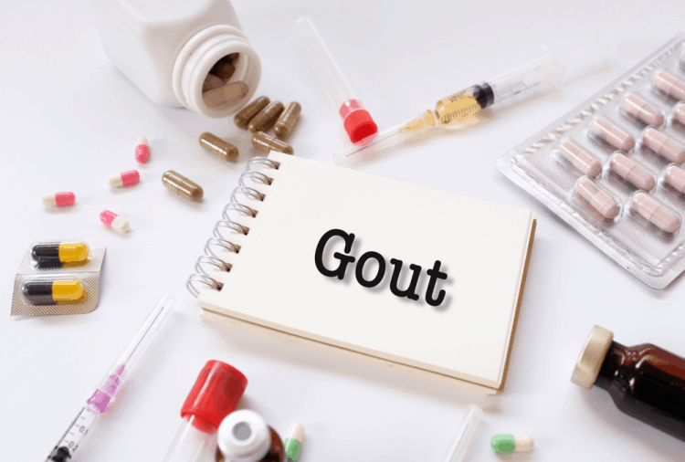 bien-chung-benh-gout-nguy-hiem-nhu-the-nao