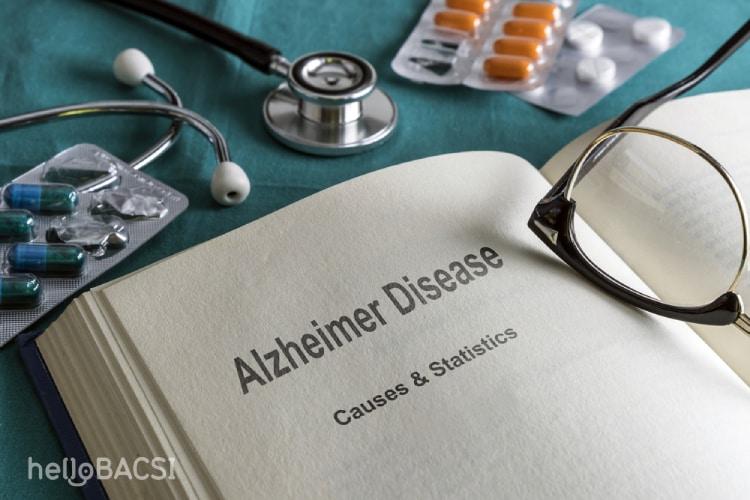 Hướng dẫn bạn cách điều trị bệnh Alzheimer