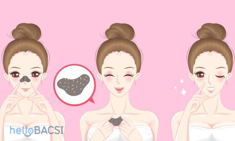 Dùng mặt nạ lột mụn để làm sạch mụn cám: Nên hay không?