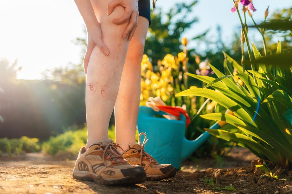 Bị suy giãn tĩnh mạch ở chân có đi bộ hay chạy bộ được không?