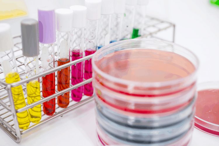 Chẩn đoán và xét nghiệm bệnh lậu