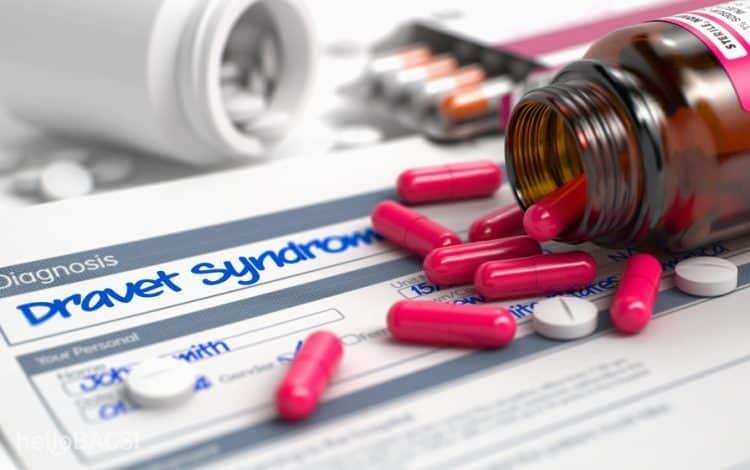 Hội chứng Dravet: Rối loạn động kinh hiếm gặp ở trẻ