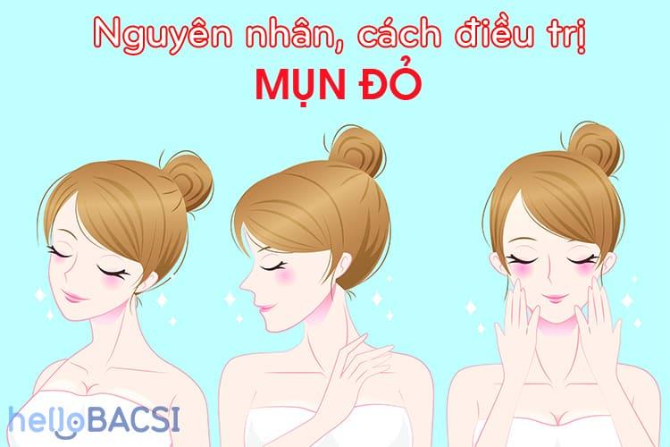 mun-do-sung-tay-nguyen-nhan-va-cach-dieu-tri