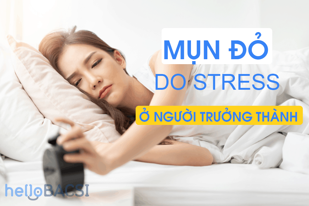 Mụn đỏ: Báo động đỏ của việc căng thẳng kéo dài