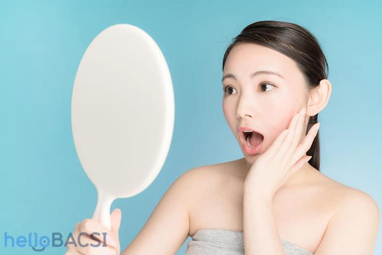 Mụn ẩn trên trán, mụn giữa 2 lông mày cảnh báo điều gì?