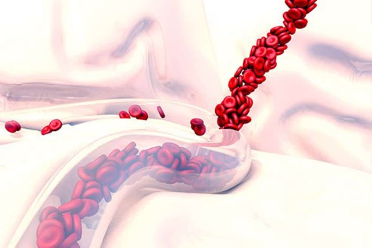 Xuất huyết nội: Bệnh nguy hiểm nhưng ít người hiểu rõ