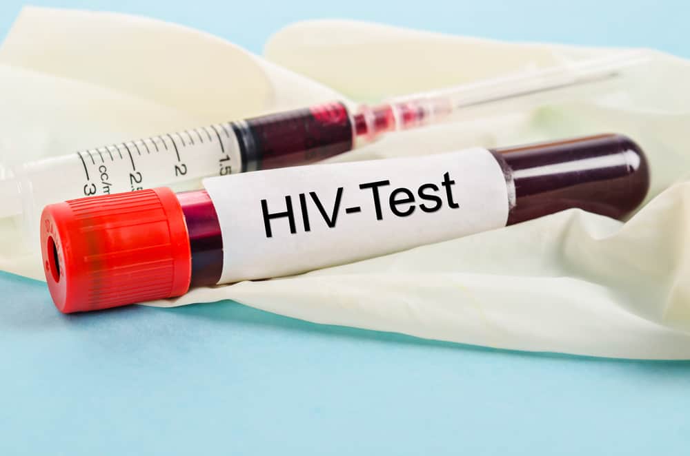 dau-hieu-hiv-o-nam