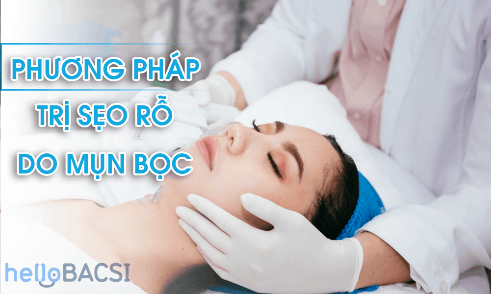 Mụn bọc để lại sẹo rỗ, đâu là giải pháp điều trị hiệu quả?