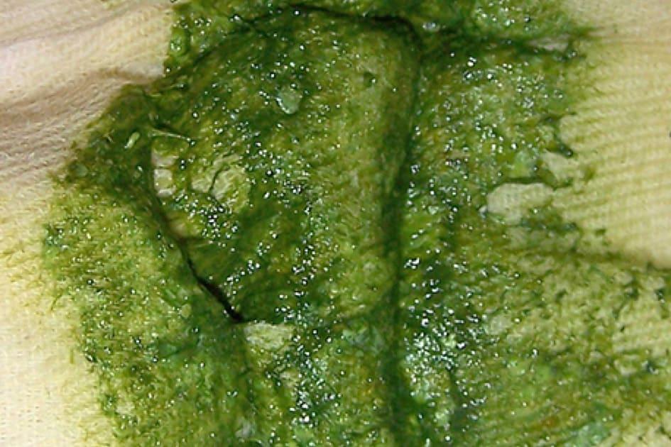 Màu xanh lá cây sáng