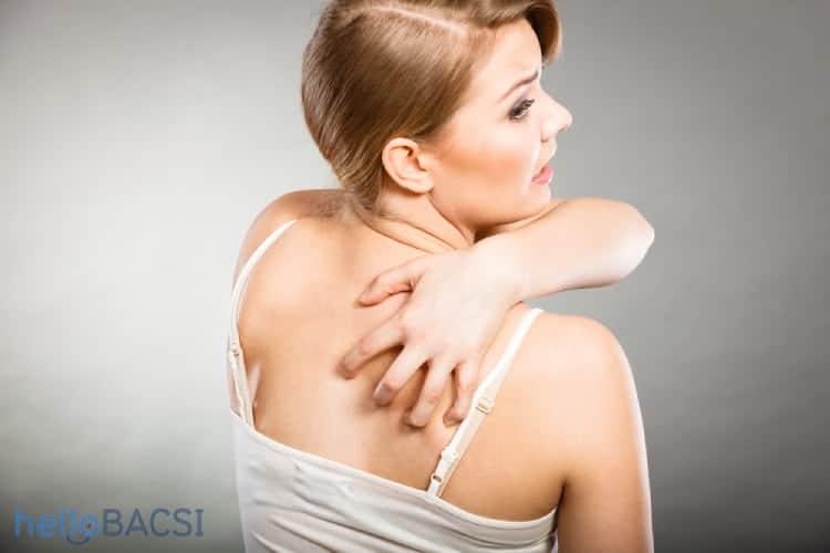 Giải đáp những thắc mắc về bệnh vảy phấn hồng