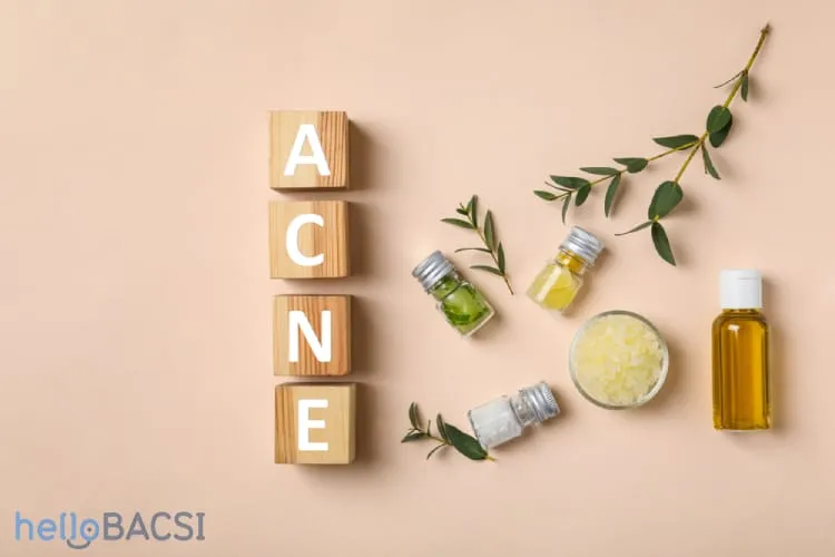 Mách nhỏ 9 loại tinh dầu trị mụn bạn không nên bỏ qua