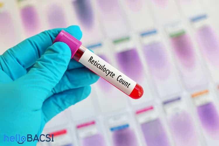 Xét nghiệm hồng cầu lưới