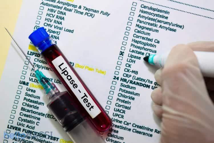 Xét nghiệm lipase