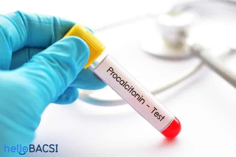 dinh-luong-procalcitonin-pct