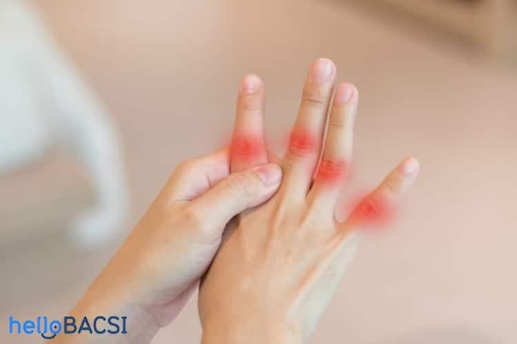 Biến dạng cổ thiên nga