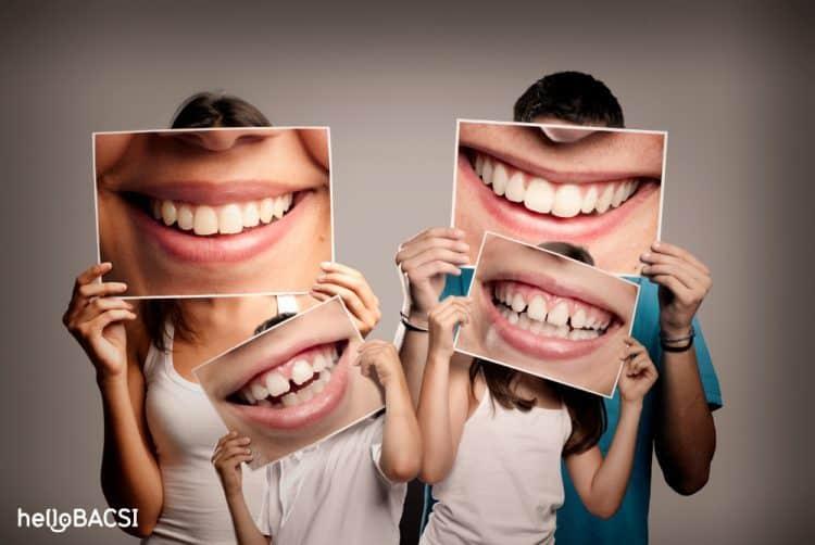 Các bệnh về răng miệng bạn dễ mắc phải