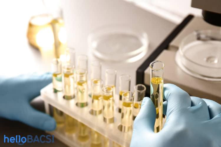 xet-nghiem-nuoc-tieu-24-gio