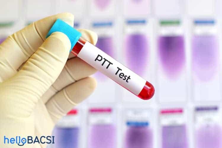Xét nghiệm thời gian thromboplastin từng phần