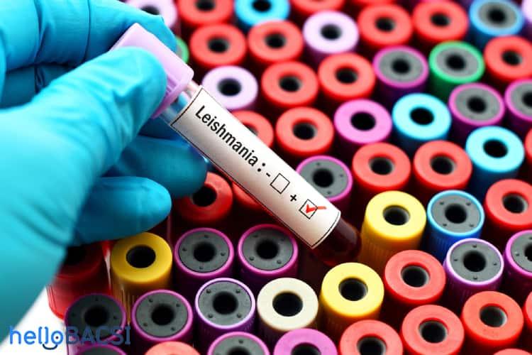 benh-do-nhiem-leishmania