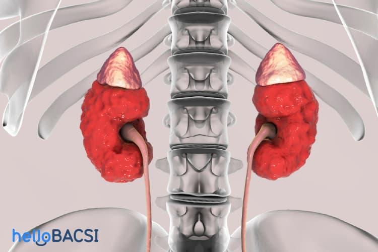 Mối liên hệ giữa thuốc chữa axit dạ dày và bệnh thận mãn tính