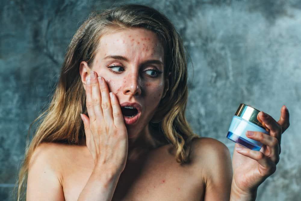 Dị ứng mỹ phẩm phải làm sao? Cách xử trí an toàn và phòng ngừa hiệu quả