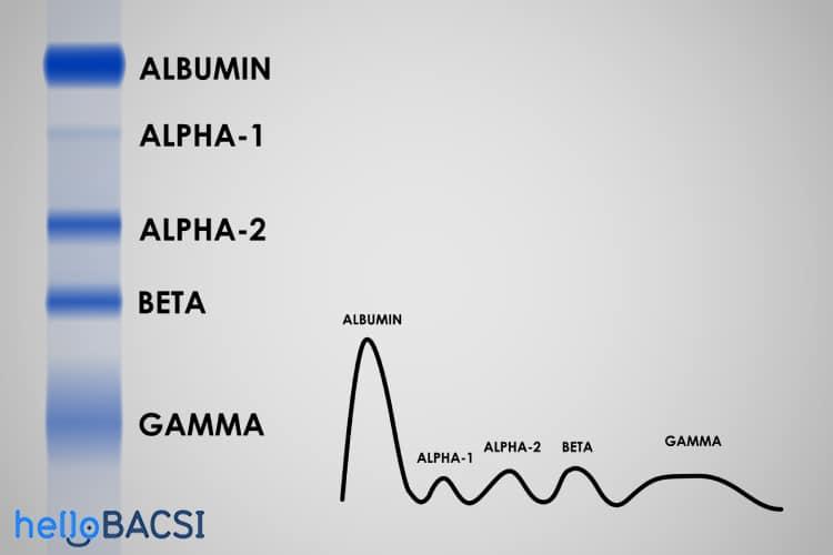 Điện di protein huyết thanh