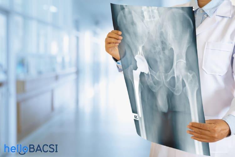 Gãy xương vùng chậu