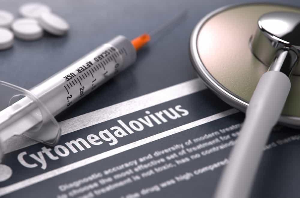 nhiem-virus-cytomegalo
