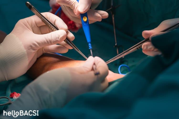 Rò động tĩnh mạch