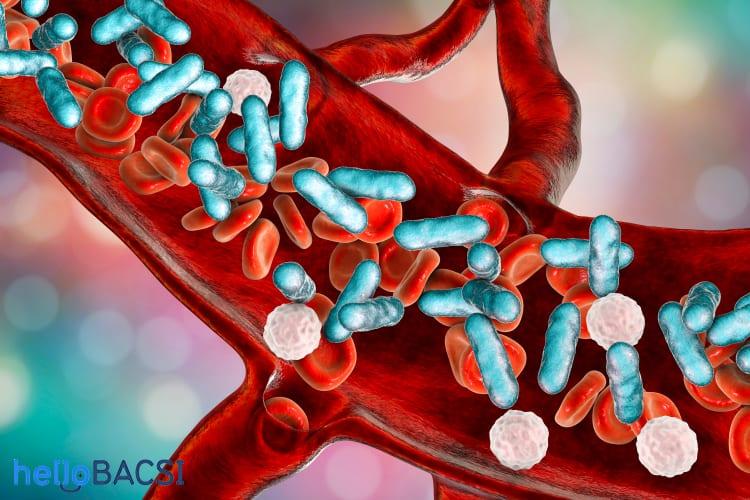 Sốc nhiễm trùng, hay sốc nhiễm khuẩn là gì mà đe dọa tính mạng?