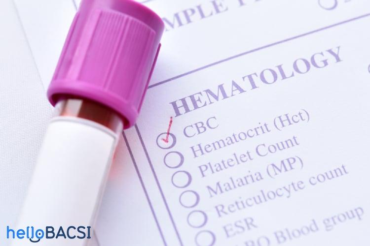 Tăng tế bào lympho