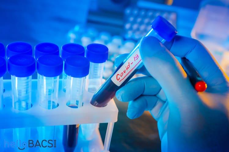 COVID-19 và SARS: Những khác biệt bạn cần biết