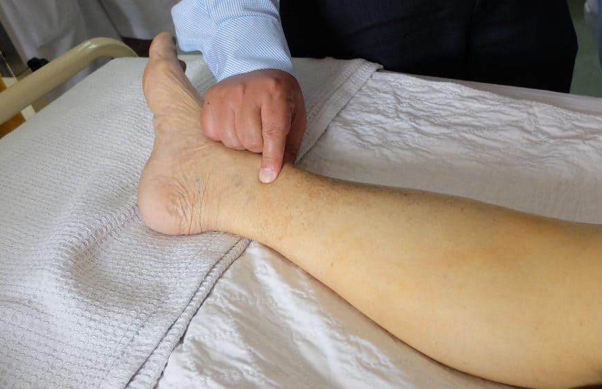 Hội chứng thận hư là gì?