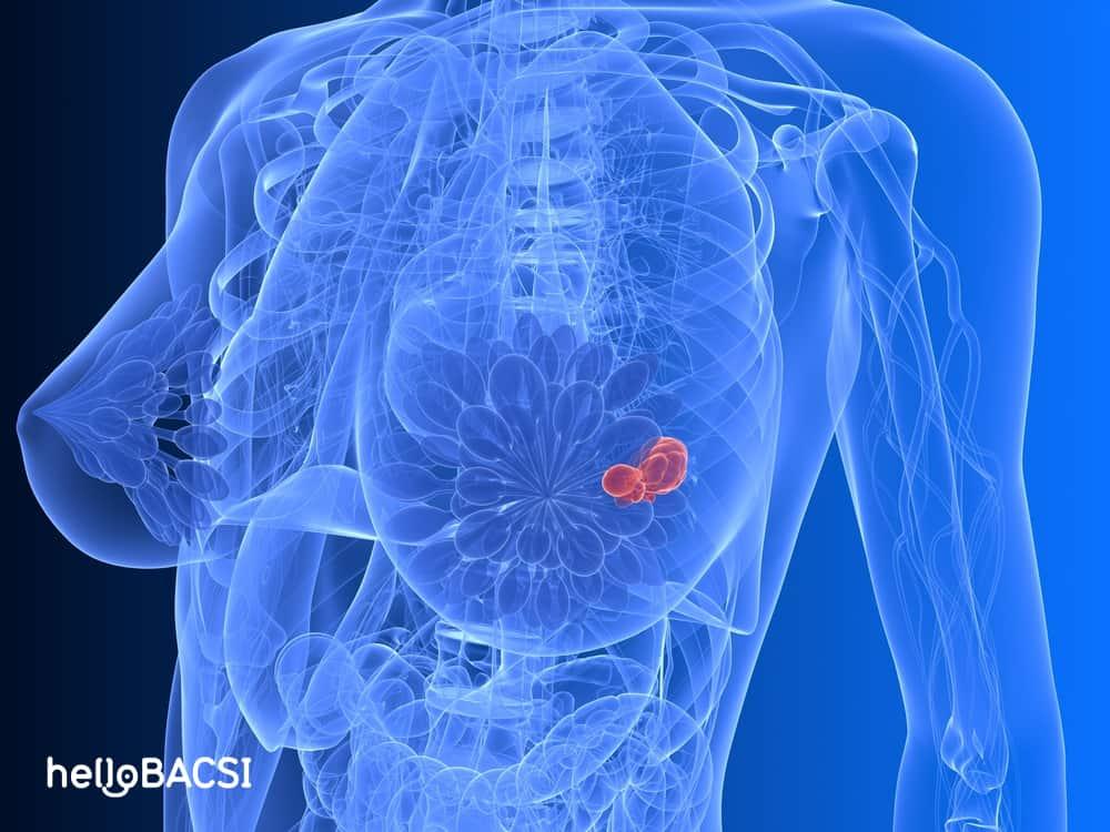 Đàn ông ngực to như phụ nữ: chữa thế nào?