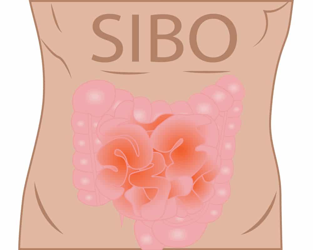 sibo