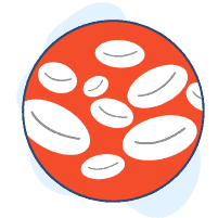 Bệnh bạch cầu