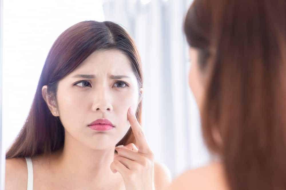 Top 8 nguyên nhân gây dị ứng da mặt - Da mặt bị dị ứng phải làm sao?