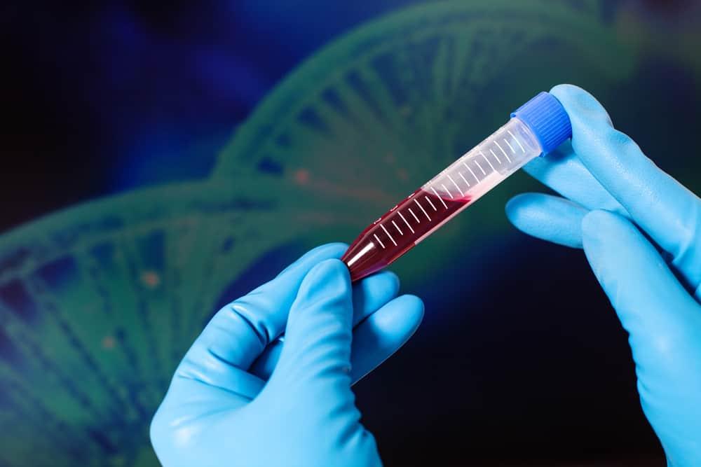 benh-hemophilia-a