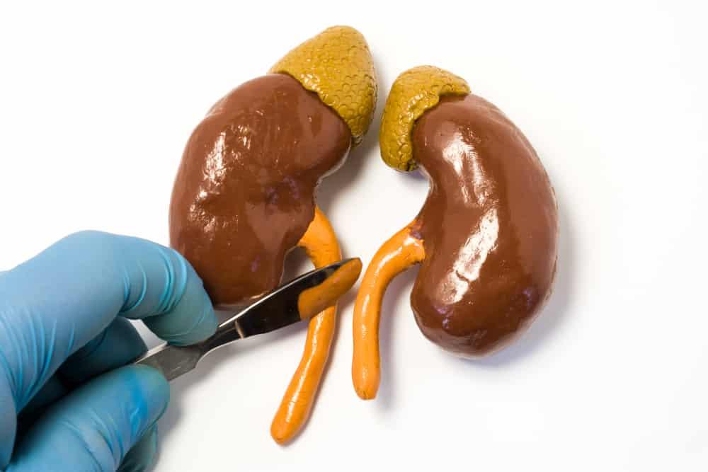 Cẩn trọng trước những biến chứng sau mổ sỏi niệu quản