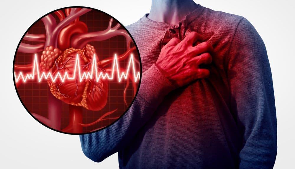 Nhồi máu cơ tim thất phải