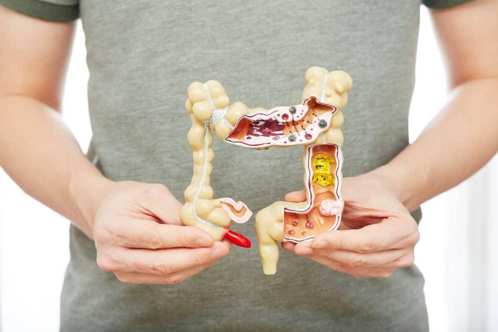 Giải đáp: Sốt tiêu chảy là bệnh gì? Khi nào bạn nên đi khám?