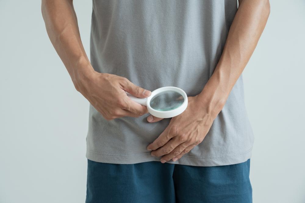 Dương vật bị ngứa do nguyên nhân gì? Làm thế nào để giảm khó chịu?