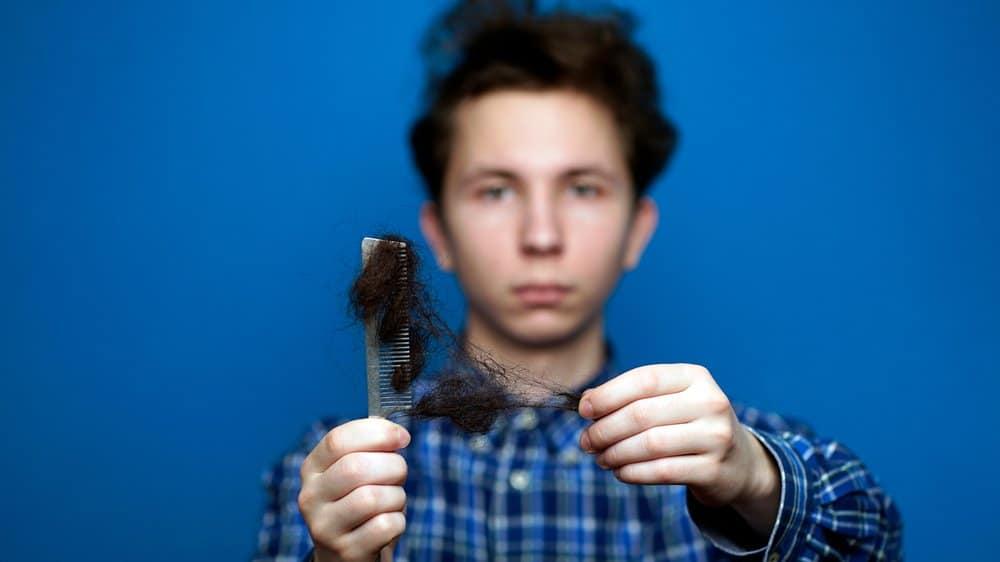 Rụng tóc nhiều ở nam tuổi dậy thì - Trẻ có thể bị hói đầu sớm?