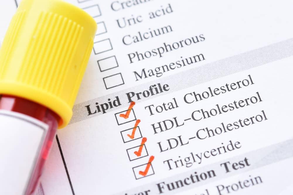cac-bien-chung-roi-loan-lipid-mau