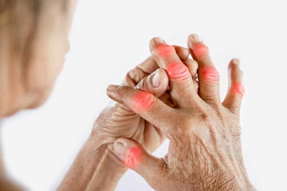 gout-cap